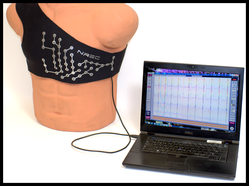 intelligent-ecg-slideshow-21