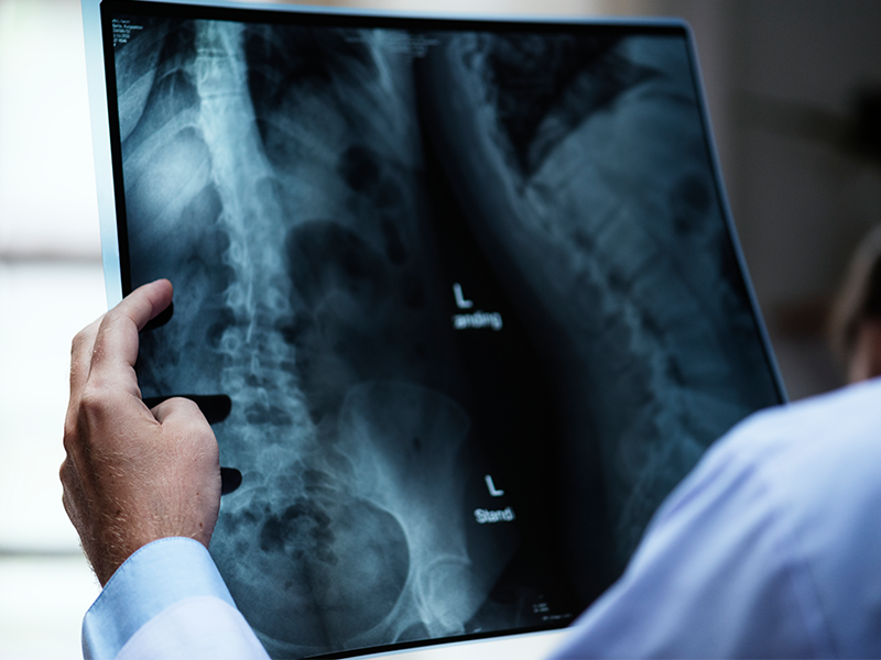 medical-imaging-slideshow-11