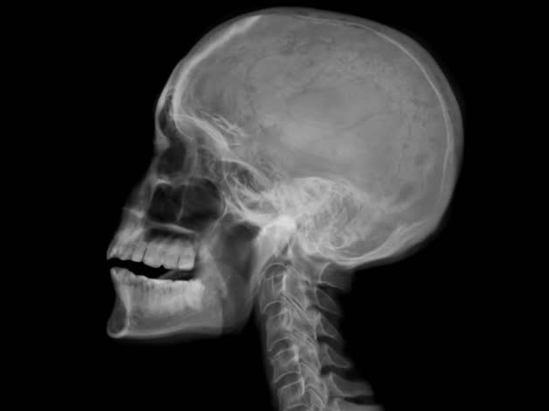 medical-imaging-slideshow-2